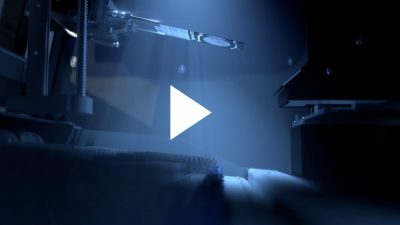 Hvordan AI og digital cytologi kan bidrage til den globale kamp for at udrydde dødsfald af livmoderhalskræft