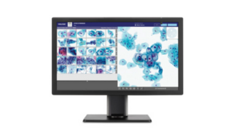 Digital cytologi med AI – hurtigere og bedre
