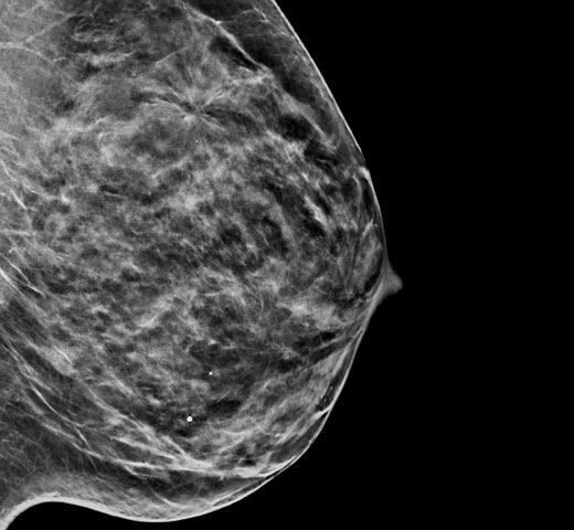 C-View™ Synthesised 2D Imaging på hvid baggrund