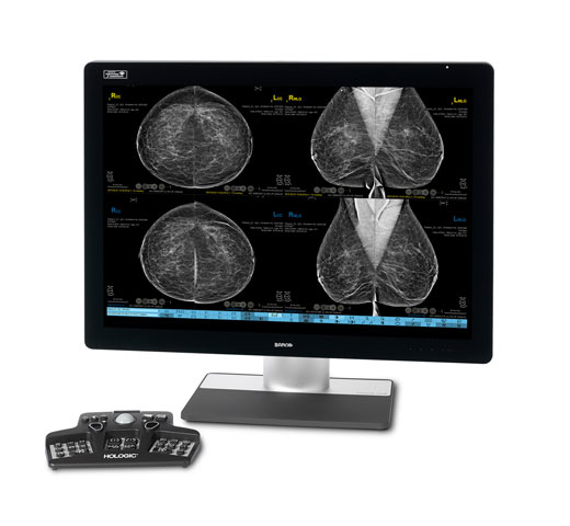 SecurView® Breast Imaging Workstation med hvid baggrund