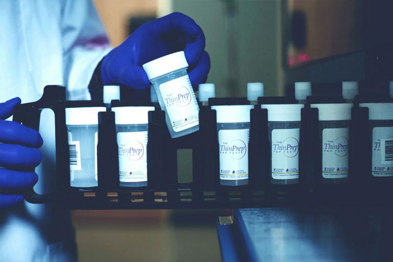 Hånd med handske tager prøveglas fra bakke