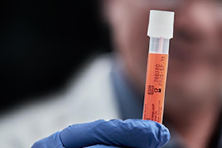 Handskeklædt hånd holder et hætteglas