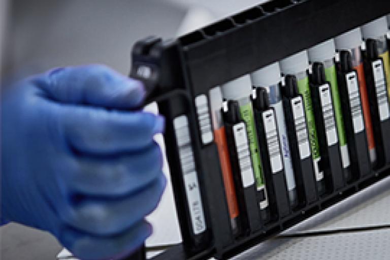 Handskeklædt hånd holder et rack med hætteglas