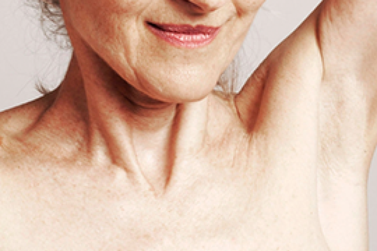 Nærbillede af kvindelig patients nakke og skulder under forberedelse til undersøgelse