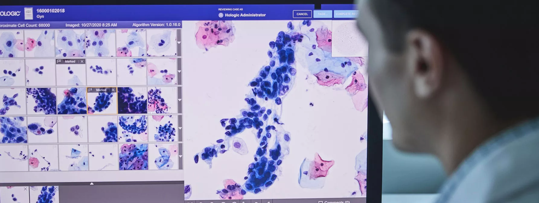 Billede af Genius™ Digital Diagnostics System