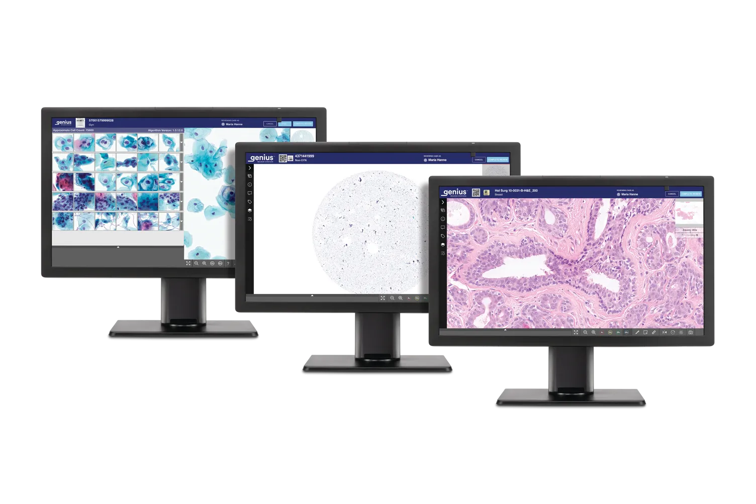 3 Genius monitorer, der viser histologi- og cytologiscanninger klar til gennemgang.