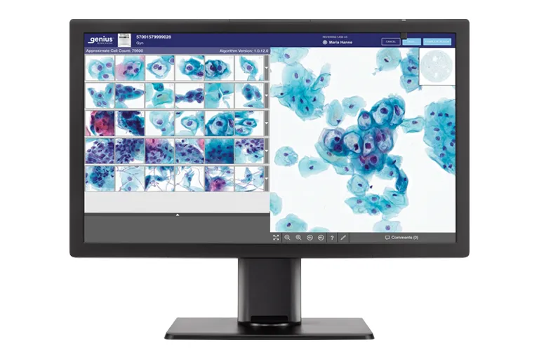 Genius monitor, der viser cytologiske celler, som er klar til gennemgang