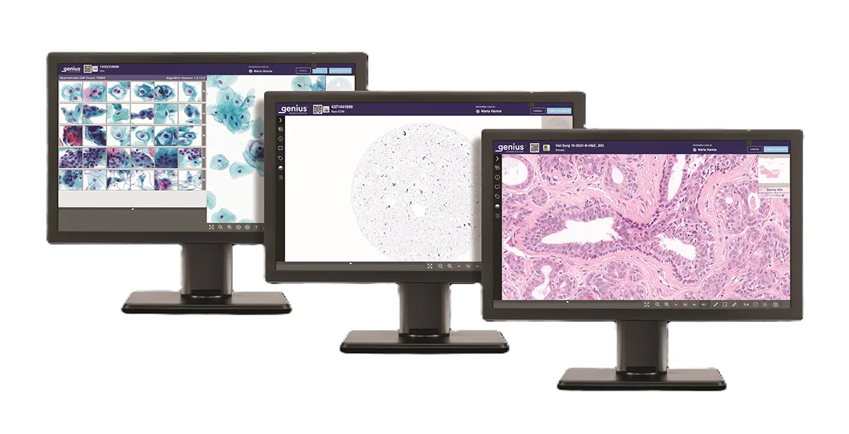Genius Review station showing diverse specimen types (Gyn, NGYN and Histology)