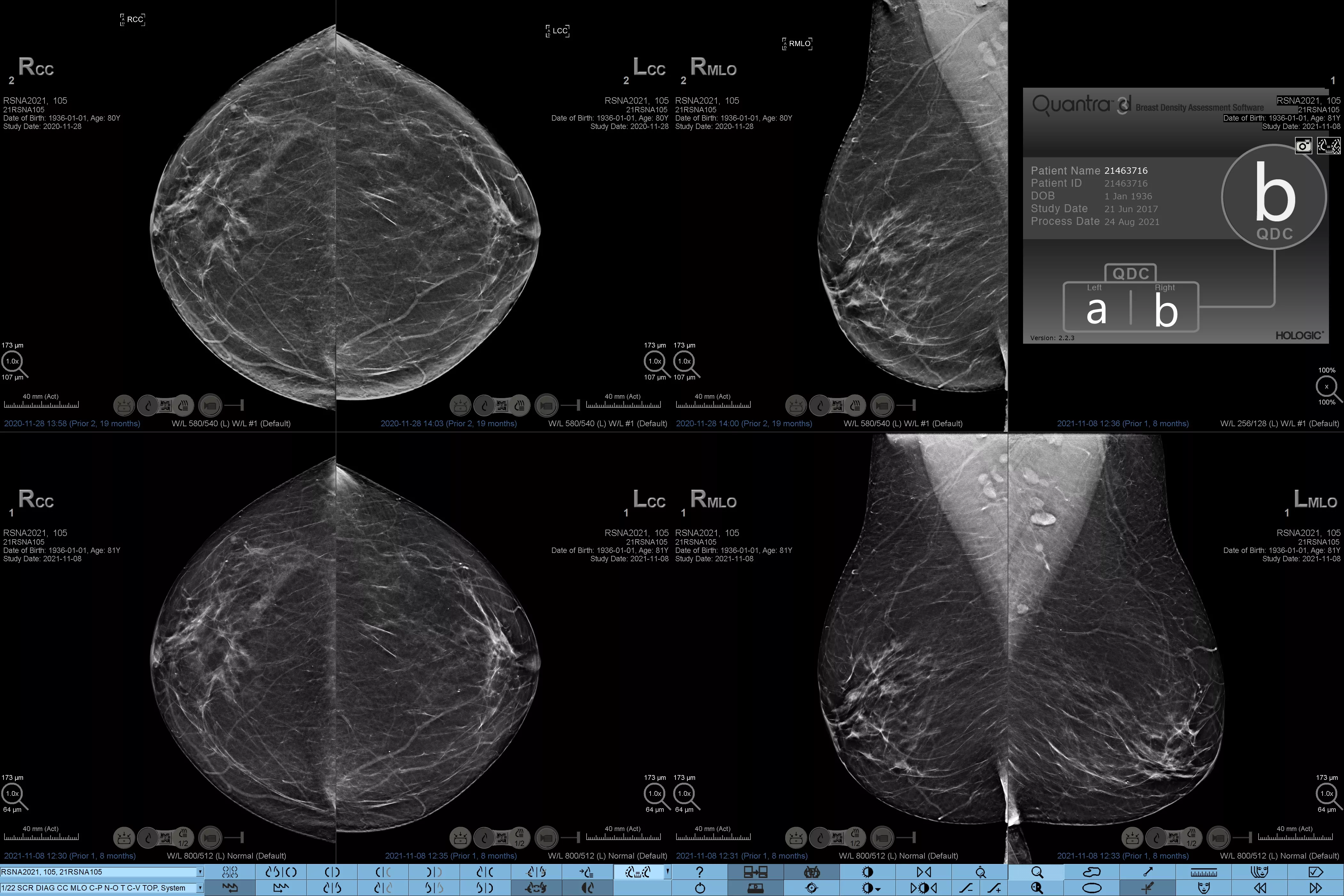 Transducer-L18-5 på hvid baggrund