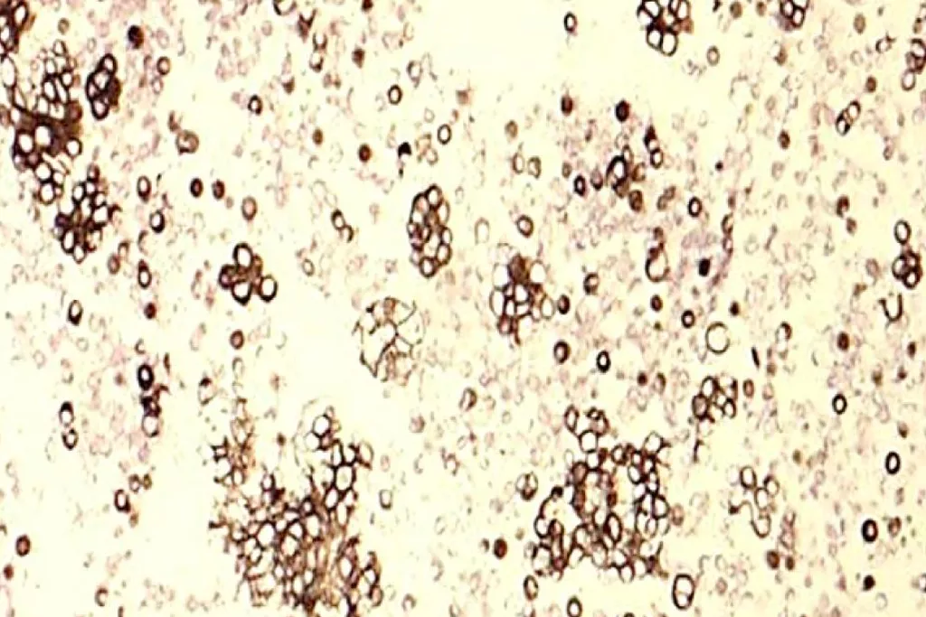 Cytokeratin 7​