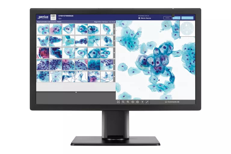 Billede af Genius-monitor