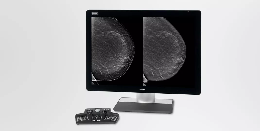 Røntgenbillede af bryst