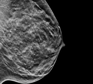 C-View™ Synthesised 2D Imaging på hvid baggrund