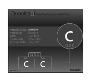 Hologic Quantra™ Technology på hvid baggrund