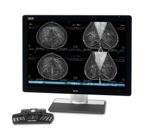 SecurView® Breast Imaging Workstation med hvid baggrund